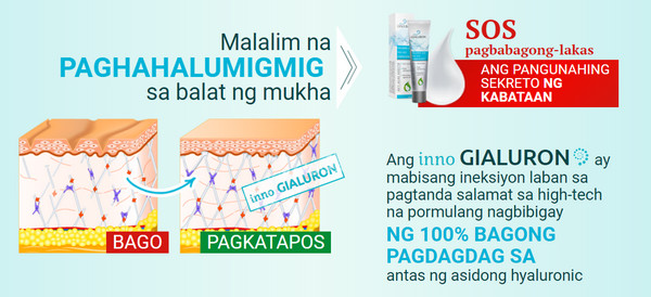 saan makakabili ng inno gialuron
